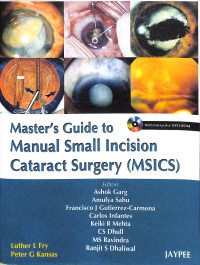 masters guide to manual small incision cataract surgery (MSICS)